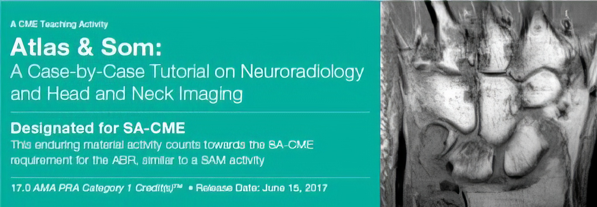 Atlas & Som: A Case-by-Case Tutorial On Neuroradiology and Head and Neck Imaging 2017
