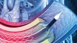 Comprehensive Review and Update of What’s New in Vascular and Endovascular Surgery 2021