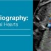 2018 Fetal Echocardiography Normal and Abnormal Hearts