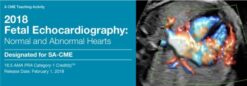 2018 Fetal Echocardiography Normal and Abnormal Hearts