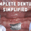 Complete Dentures Simplified
