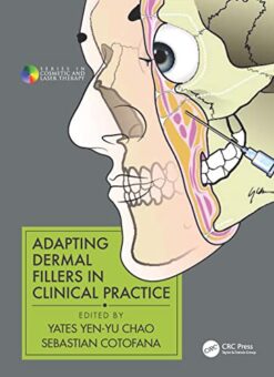Adapting Dermal Fillers in Clinical Practice (Original PDF from Publisher)