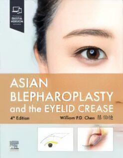 Asian Blepharoplasty And The Eyelid Crease, 4th Edition (EPub+Converted PDF)