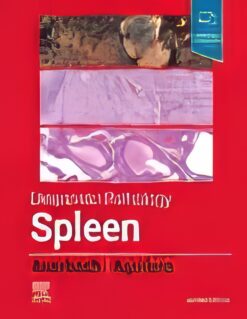 Diagnostic Pathology: Spleen, 2nd Edition (Original PDF from Publisher)