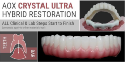 AOX Crystal Ultra Hybrid Restoration: All Clinical & Lab Steps Start to Finish