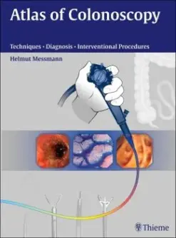 Atlas Of Colonoscopy: Examination Techniques And Diagnosis