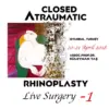 Closed Atraumatic Rhinoplasty Live Surgery DVD 1 / Digital