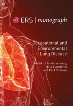 ERS Monograph 89: Occupational and Environmental Lung Disease (Original PDF from Publisher)