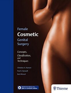 Female Cosmetic Genital Surgery: Concepts, Classification And Techniques (EPUB)