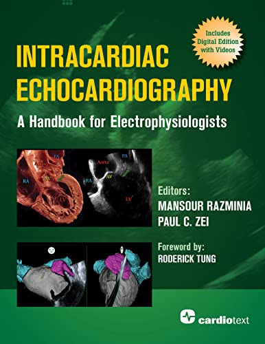 Intracardiac Echocardiography A Handbook for Electrophysiologists (Original PDF from Publisher)