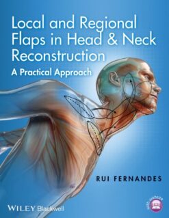 Local And Regional Flaps In Head And Neck Reconstruction: A Practical Approach (Videos+PPT)
