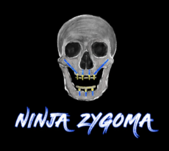 Ninja Zygoma – Implant Ninja