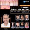 OHI-S Saving Hopeless Teeth, Surgical and Conservative Protocols