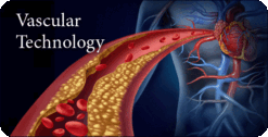 Pegasus Vascular Technology Review 2022