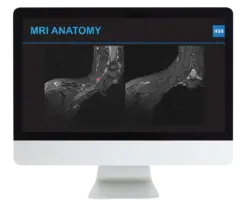 Plexus and Peripheral Nerve Imaging 2024