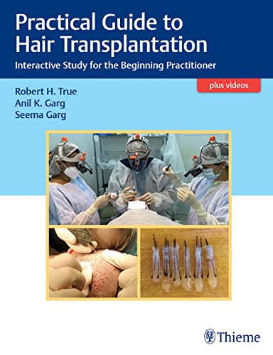 Practical Guide To Hair Transplantation: Interactive Study For The Beginning Practitioner (Original PDF From Publisher+Videos)
