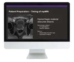 Prostate MR Case Review 2024