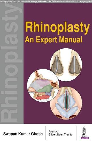 Rhinoplasty: An Expert Manual (Original PDF From Publisher)