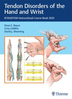 Tendon Disorders Of The Hand And Wrist: IFSSH/FESSH Instructional Course Book 2022 (Original PDF From Publisher)