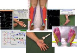 EMG/NCS Online Series: Volume III Sensory Nerve Conduction Studies