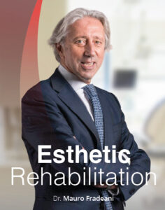 Esthetic Rehabilitation Esthetic and Functional Integration of the Prosthetic Rehabilitation (CME VIDEOS)