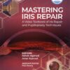 Mastering Iris Repair: A Video Textbook of Iris Repair and Pupilloplasty Techniques (PDF Book)