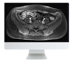 ARRS A Guide to Bowel Imaging 2019 (CME VIDEOS)