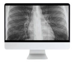 ARRS Liver, Pancreatic, and Biliary Tumors 2022