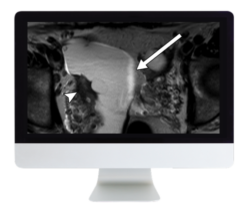 ARRS Women’s Imaging 2019 (CME VIDEOS)