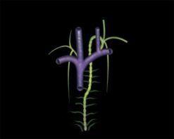 MRIOnline Mastery Series: Brachial Plexus 2022