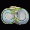 MRI Online MRI Mastery Series Elbow 2021