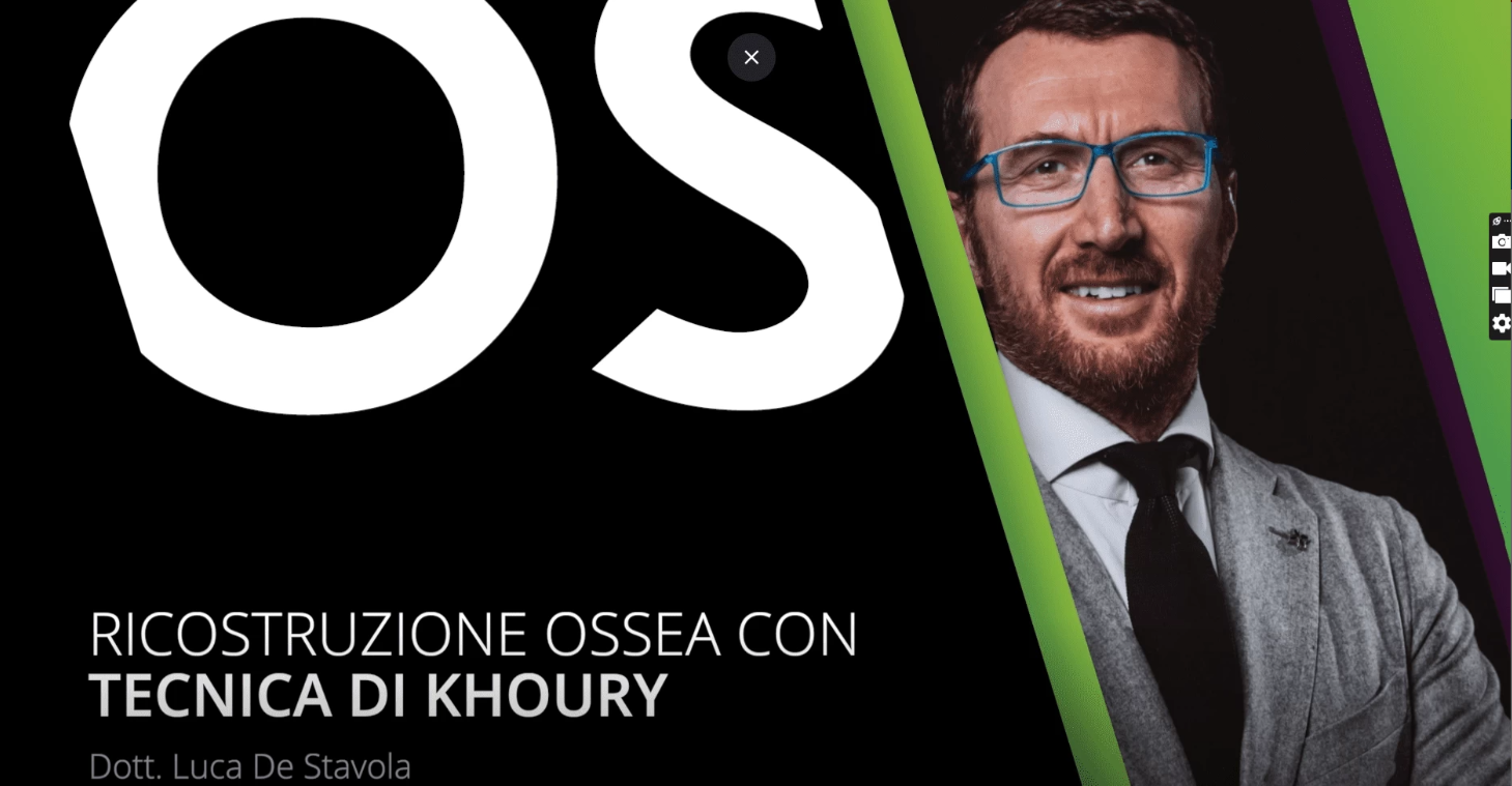 Ricostruzione ossea con tecnica di Khoury (Italiano) Dott. Luca De Stavola