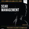 Procedures in Cosmetic Dermatology Scar Management by Jessica G. Labadie 2025