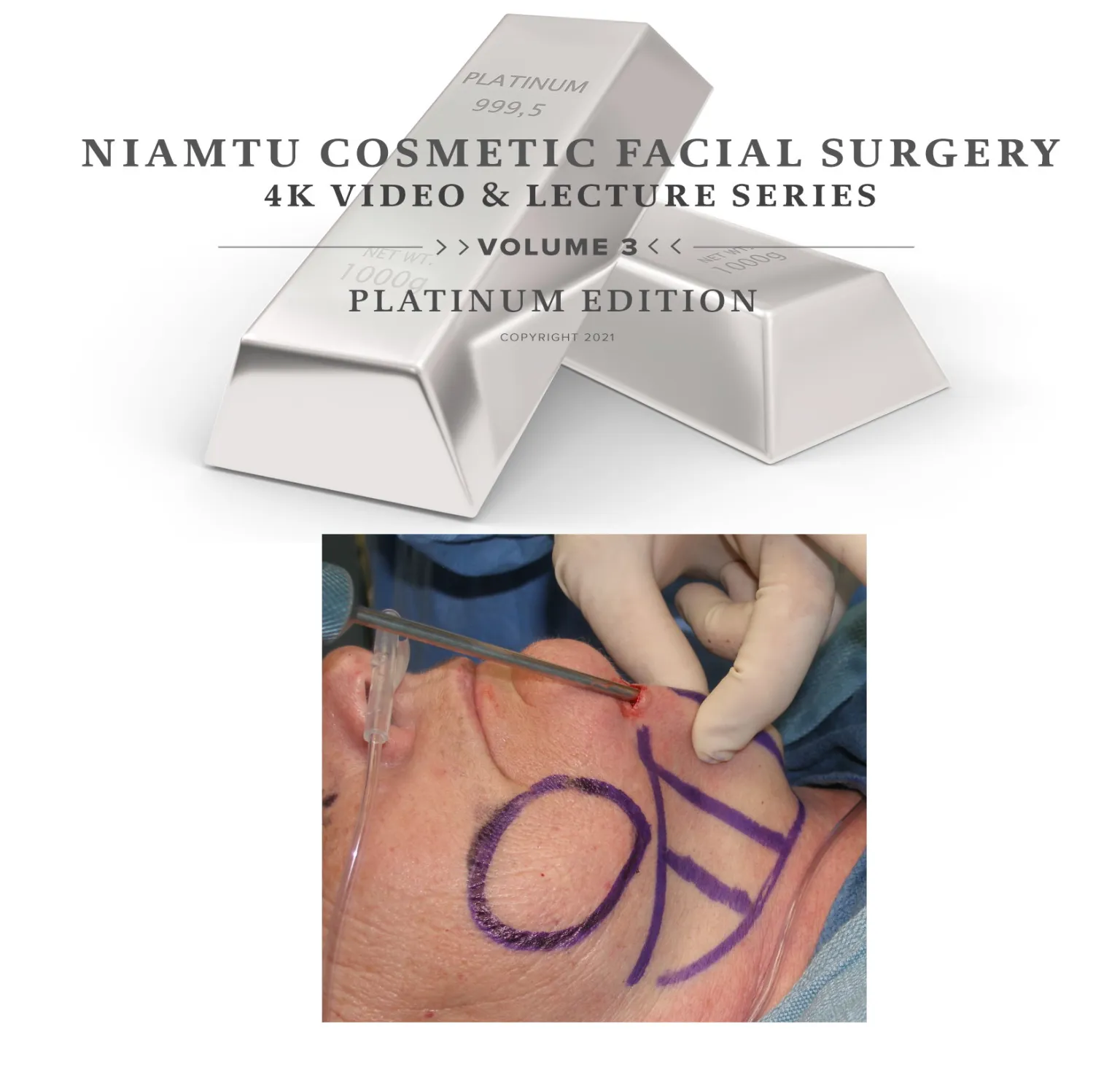 Facial Liposuction, Buccal Fat Reduction, Fat Transfer