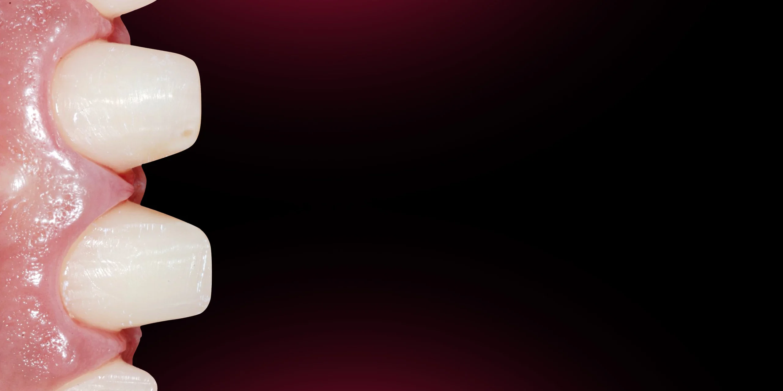 OHI-S Aesthetic Dentistry Online Congress