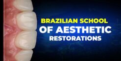 OHI-S Brazilian School of Aesthetic Restorations