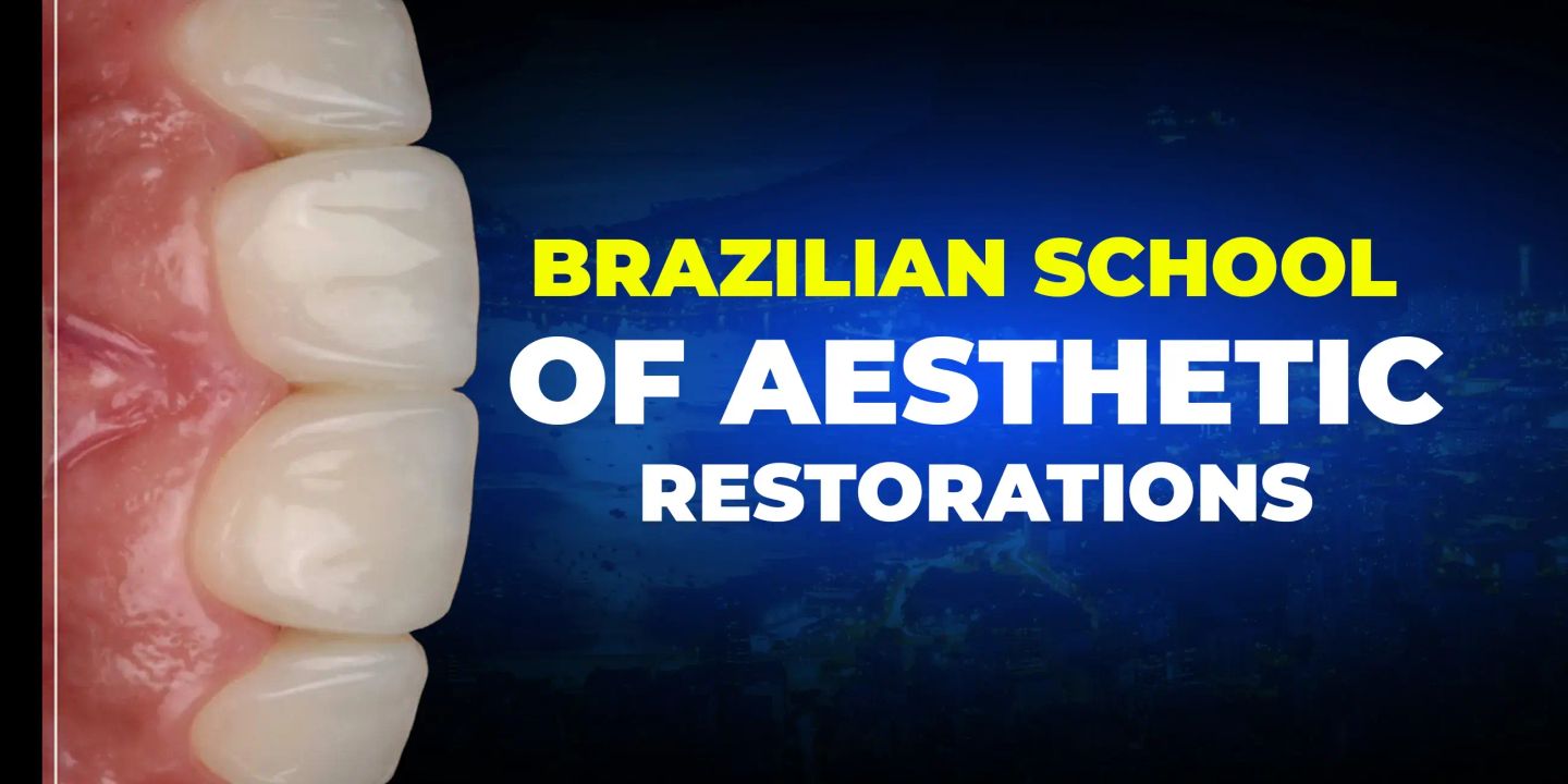 OHI-S Brazilian School of Aesthetic Restorations