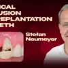 OHI-S Surgical Extrusion and Replantation of Teeth