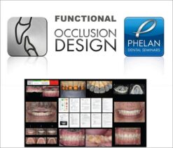 Functional Occlusion Design Dental Seminars