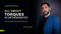 Kleber Meireles System All About Torques In Orthodontics
