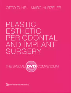 Plastic-Esthetic Periodontal and Implant Surgery The Special DVD Compendium