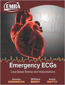 Emergency ECGs: Case-Based Review and Interpretations (EPUB)