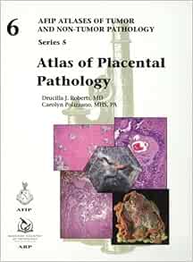Atlas of Placental Pathology (AFIP Atlas of Tumor and Non-Tumor Pathology, Series 5, Volume 6) (Original PDF from Publisher)