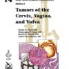 Tumors of the Cervix, Vagina, and Vulva (AFIP Atlas of Tumor Pathology, Series 5) (Original PDF from Publisher)
