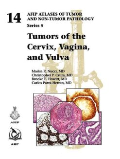 Tumors of the Cervix, Vagina, and Vulva (AFIP Atlas of Tumor Pathology, Series 5) (Original PDF from Publisher)