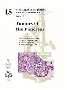 Tumors of the Pancreas (AFIP Atlas of Tumor and Non-Tumor Pathology, Series 5, 15) (Original PDF from Publisher)