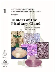Tumors of the Pituitary Gland (AFIP Atlas of Tumor and Non-Tumor Pathology, Series 5, Fascicle 1) (Original PDF from Publisher)