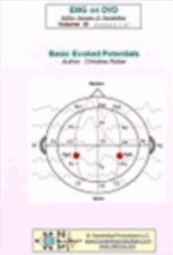 EMG/NCS Online Series: Volume XI Evoked Potentials