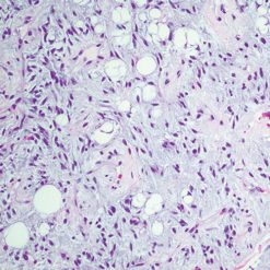 Cleveland Clinic Comprehensive and Immersive Soft Tissue Pathology 2025