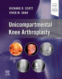 Unicompartmental Knee Arthroplasty (Original PDF from Publisher)